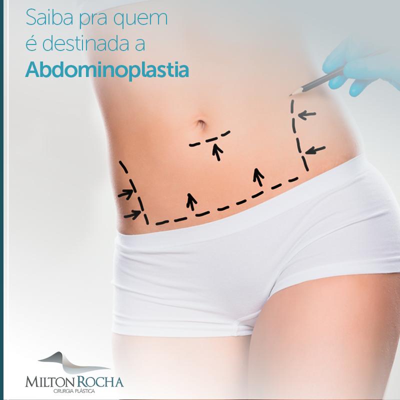 Leia mais sobre o artigo Saiba para quem é destinada abdominoplastia